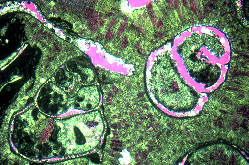 photomicrograph of a near-back-reef grainstone in the Tansill Formation